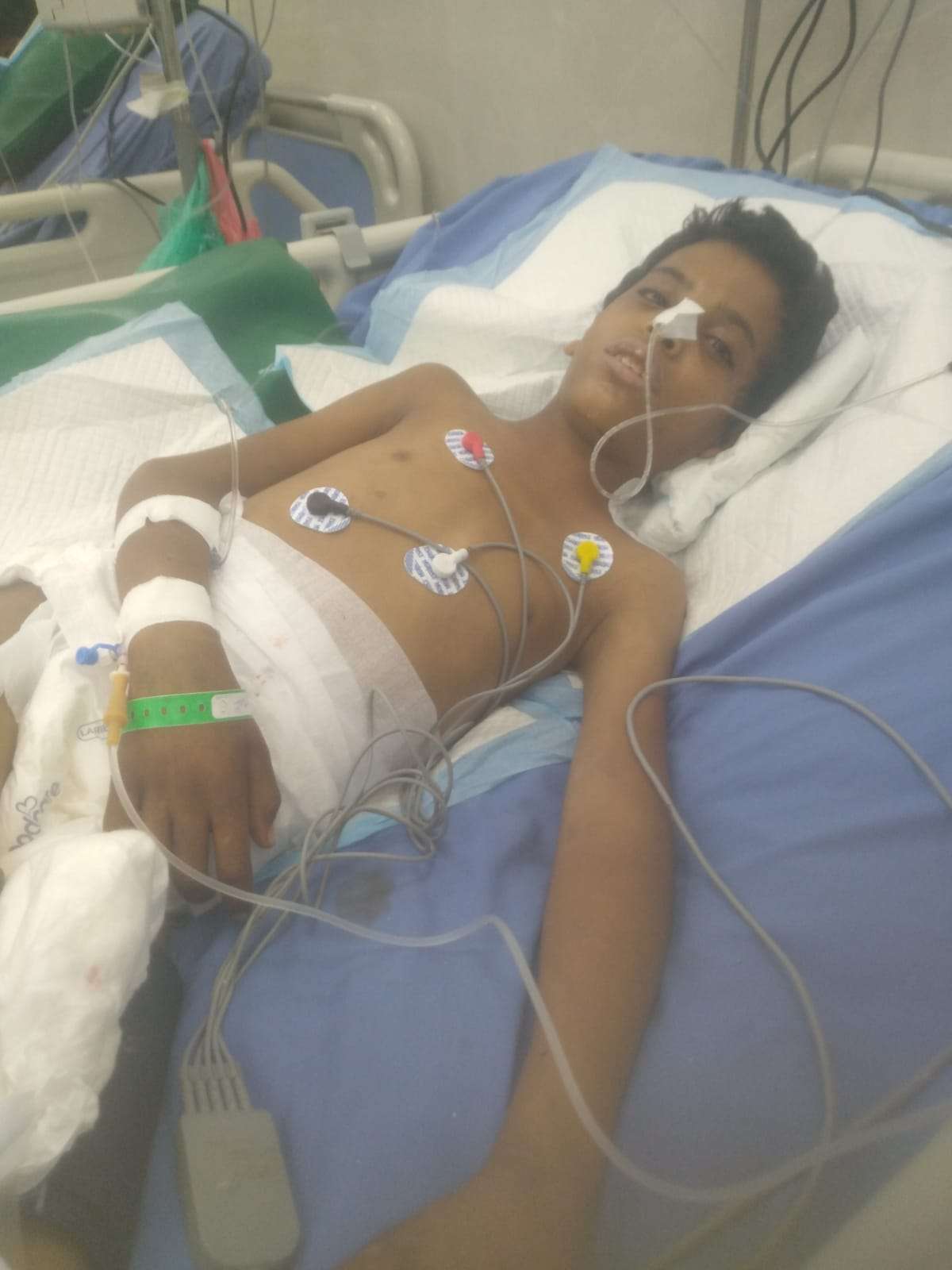 استشهاد الطفل عدي عبدالعزيز متأثرًا بإصابته برصاص قناص حوثي في كرش   ا